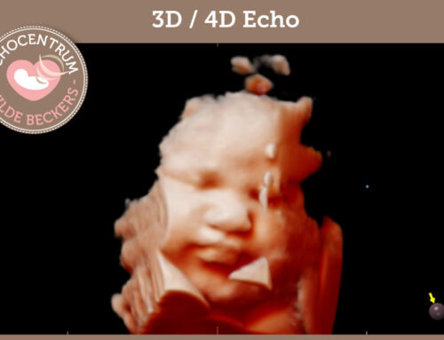 3D 4D echo gezichtje 03