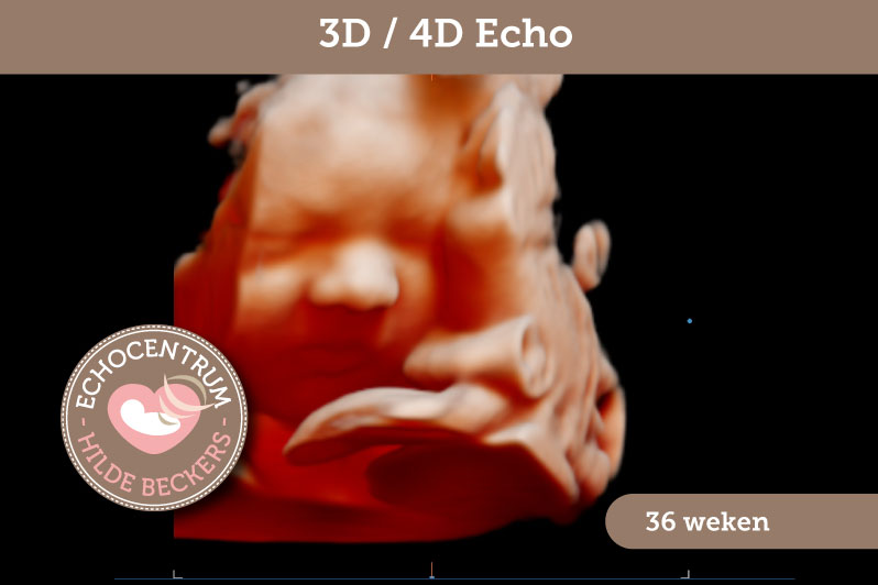 Afbeelding EchoCentrum Hilde Beckers 3D 4D echo 36 weken